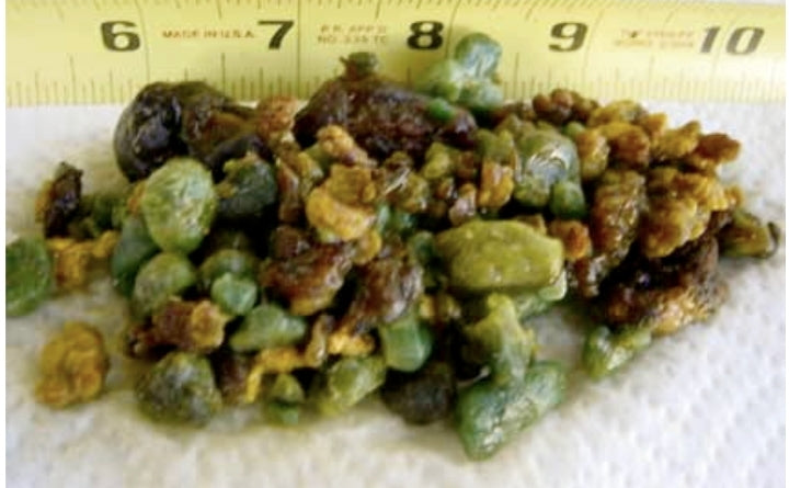 Gallbladder & Liver Detoxifying Traditional Botanical supplement.y